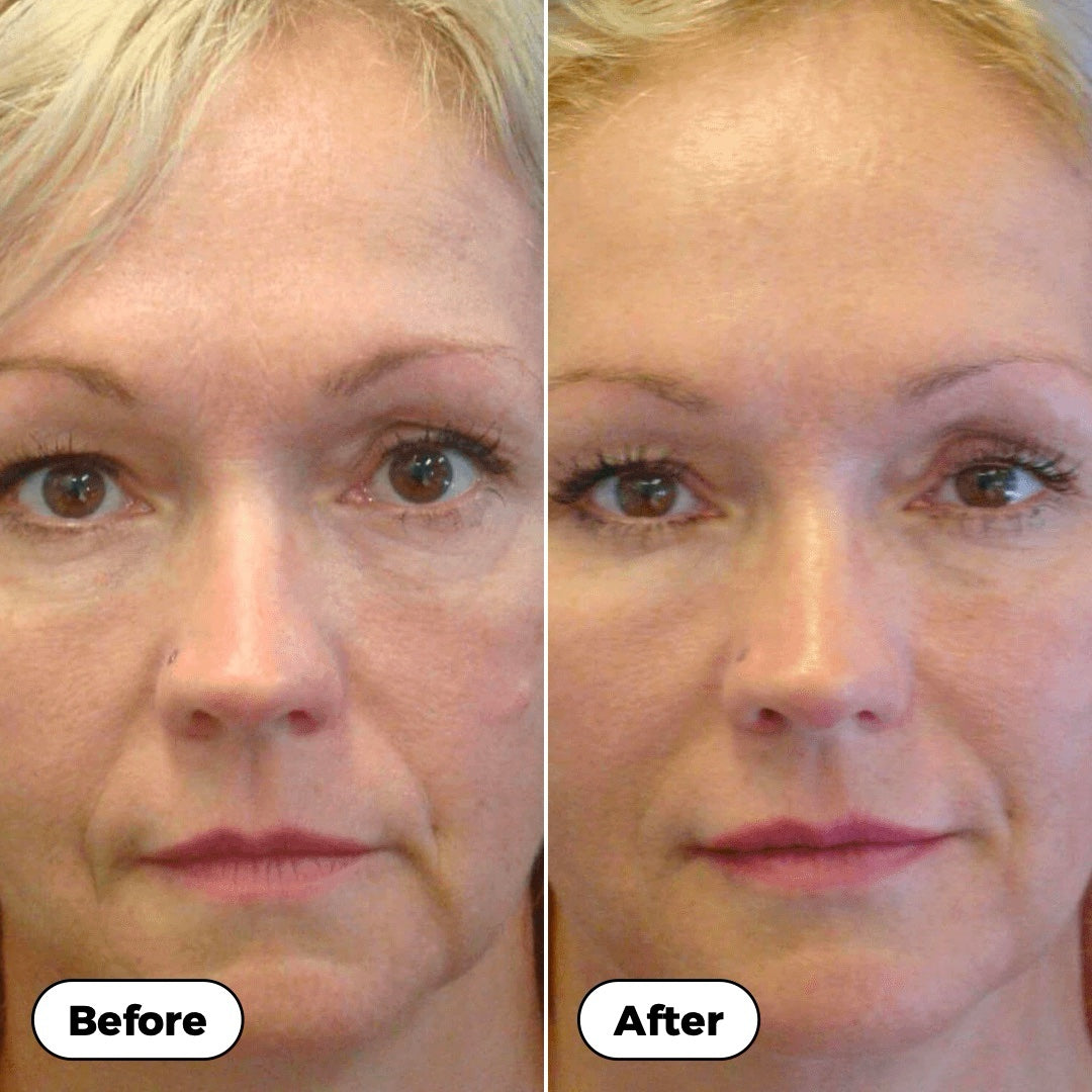 Before and after: a front-facing portrait with smoother, firmer-looking skin